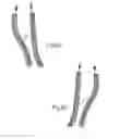 Fig. 28 - BRACE OR SUPPORT WITH ATFL SUPPORT