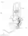 Fig. 07 - Orthosis for range of motion