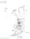 Fig. 19 - Orthosis for range of motion