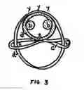 Fig. 04 - Elastic Pressure Device