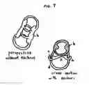 Fig. 07 - Elastic Pressure Device