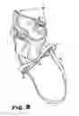 Fig. 08 - Elastic Pressure Device