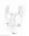 Fig. 02 - Post surgical procedure undergarment