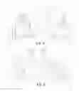 Fig. 04 - Post surgical procedure undergarment