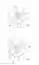 Fig. 04 - Apparatus and method for generating cut surfaces in the cornea of an eye for correction of ametropia