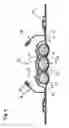 Fig. 06 - Absorbent cores having material free areas