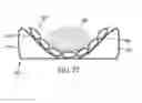 Fig. 24 - Patient turning and positioning system device