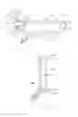 Fig. 03 - Medical device for constricting venous outflow and for providing vibratory stimulus