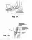Fig. 03 - Implantable electroacupuncture system and method for treating dyslipidemia and obesity
