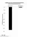 Fig. 12 - COMPOSITIONS COMPRISING DASATINIB FOR TREATING COMPLEX REGIONAL PAIN SYNDROME