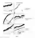 Fig. 04 - Methods and compositions for treating metabolic syndrome