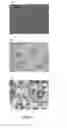 Fig. 02 - Methods and compositions of bile acids and salts for reduction of fat