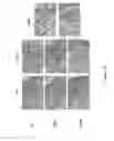 Fig. 22 - Methods and compositions of bile acids and salts for reduction of fat