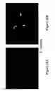 Fig. 19 - METHODS AND COMPOSITIONS FOR DISRUPTING BIOFILM UTILIZING CHITOSAN-DERIVATIVE COMPOUNDS
