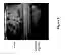 Fig. 33 - METHODS AND COMPOSITIONS FOR DISRUPTING BIOFILM UTILIZING CHITOSAN-DERIVATIVE COMPOUNDS