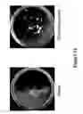 Fig. 34 - METHODS AND COMPOSITIONS FOR DISRUPTING BIOFILM UTILIZING CHITOSAN-DERIVATIVE COMPOUNDS