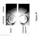 Fig. 35 - METHODS AND COMPOSITIONS FOR DISRUPTING BIOFILM UTILIZING CHITOSAN-DERIVATIVE COMPOUNDS