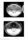 Fig. 11 - TREATMENT OF VAGINITIS