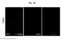Fig. 14 - COMPOSITION FOR TREATING ISCHEMIC DISEASES OR NEUROINFLAMMATORY DISEASES CONTAINING NEURAL PROGENITOR CELLS OR SECRETOME THEREOF AS ACTIVE INGREDIENT