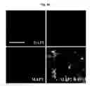Fig. 15 - COMPOSITION FOR TREATING ISCHEMIC DISEASES OR NEUROINFLAMMATORY DISEASES CONTAINING NEURAL PROGENITOR CELLS OR SECRETOME THEREOF AS ACTIVE INGREDIENT