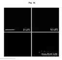 Fig. 17 - COMPOSITION FOR TREATING ISCHEMIC DISEASES OR NEUROINFLAMMATORY DISEASES CONTAINING NEURAL PROGENITOR CELLS OR SECRETOME THEREOF AS ACTIVE INGREDIENT