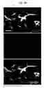 Fig. 18 - COMPOSITION FOR TREATING ISCHEMIC DISEASES OR NEUROINFLAMMATORY DISEASES CONTAINING NEURAL PROGENITOR CELLS OR SECRETOME THEREOF AS ACTIVE INGREDIENT