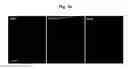Fig. 21 - COMPOSITION FOR TREATING ISCHEMIC DISEASES OR NEUROINFLAMMATORY DISEASES CONTAINING NEURAL PROGENITOR CELLS OR SECRETOME THEREOF AS ACTIVE INGREDIENT