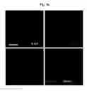 Fig. 22 - COMPOSITION FOR TREATING ISCHEMIC DISEASES OR NEUROINFLAMMATORY DISEASES CONTAINING NEURAL PROGENITOR CELLS OR SECRETOME THEREOF AS ACTIVE INGREDIENT