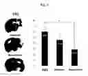 Fig. 26 - COMPOSITION FOR TREATING ISCHEMIC DISEASES OR NEUROINFLAMMATORY DISEASES CONTAINING NEURAL PROGENITOR CELLS OR SECRETOME THEREOF AS ACTIVE INGREDIENT