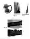 Fig. 05 - Umbilical tissue compositions and methods of use