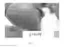 Fig. 03 - Topical Compositions And Methods For Treating Wounds