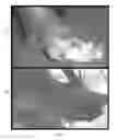 Fig. 06 - Topical Compositions And Methods For Treating Wounds