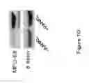 Fig. 07 - COMPOSITIONS AND METHODS OF REGULATING BONE RESORPTION