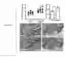 Fig. 18 - COMPOSITIONS AND METHODS OF REGULATING BONE RESORPTION