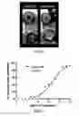 Fig. 03 - Wound debridement compositions containing seaprose and methods of wound treatment using same