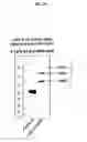 Fig. 08 - GLYCOPEGYLATED FACTOR IX