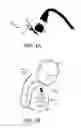 Fig. 02 - COMPOSITIONS AND METHODS FOR VAS-OCCLUSIVE CONTRACEPTION