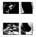 Fig. 04 - Biodegradable scaffolds