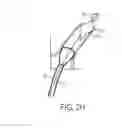 Fig. 06 - Systems and Methods for Removing Undesirable Material Within a Circulatory System