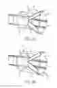 Fig. 07 - Systems and Methods for Removing Undesirable Material Within a Circulatory System