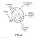 Fig. 05 - Synchronizing breast pumping with infant feeding