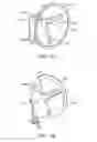 Fig. 12 - Apparatus and methods to create posterior compression at the breast during expression of breast milk