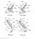 Fig. 24 - Apparatus and methods to create posterior compression at the breast during expression of breast milk
