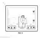 Fig. 06 - Wireless diagnostic system for indirect flow measurement in artificial heart pumps
