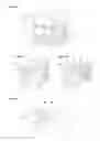 Fig. 04 - Spring arrangement and drug delivery device herewith