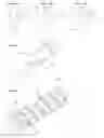 Fig. 06 - Spring arrangement and drug delivery device herewith