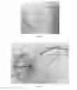 Fig. 03 - Device