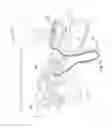 Fig. 02 - Remote respiratory therapy device management