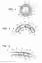 Fig. 02 - CATHETER STIFFNESS ADJUSTMENT SYSTEM AND METHOD