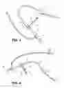 Fig. 04 - Sheath